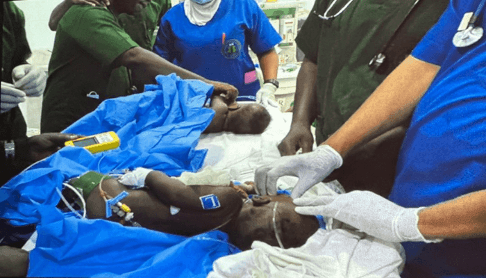 Modibbo Adamu University Hospital Performs Landmark Free Surgery to Separate Conjoined Twins